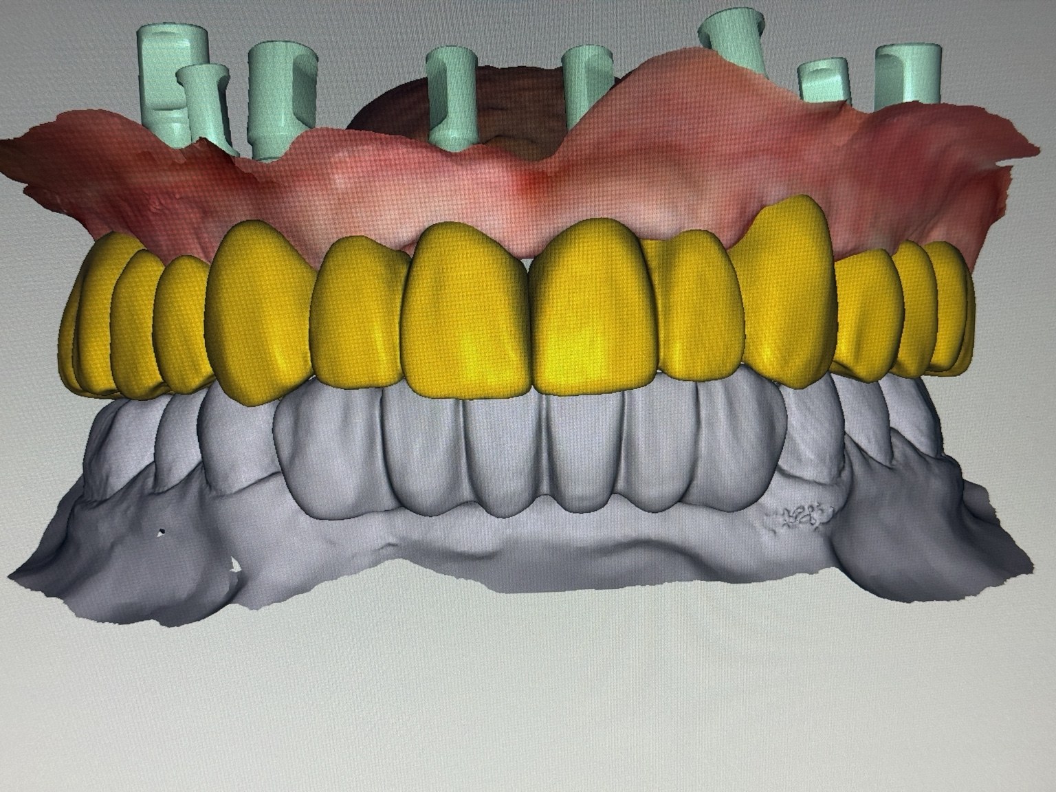 Digital dental cases, without losing the personal connection.