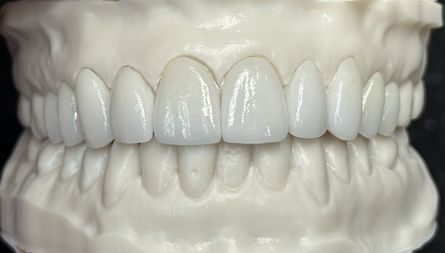 Anterior Esthetic Study